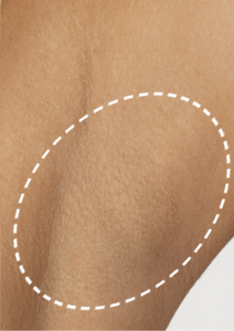 Side-by-Side Comparison – Mave IPL Hair Removal Progress Over Time