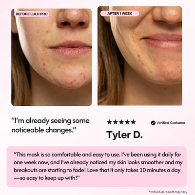 Lulu Pro LED Light Therapy Mask - Smuuv Body