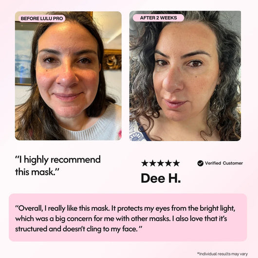 Lulu Pro LED Light Therapy Mask - Smuuv Body